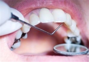آغاز پویش ملی سلامت دهان و دندان در تبریز