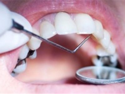 آغاز پویش ملی سلامت دهان و دندان در تبریز